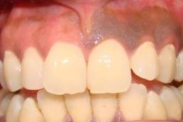 امراض اللثة