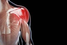 اعراض التهاب العضلات