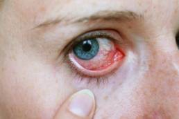 متلازمة بهجت